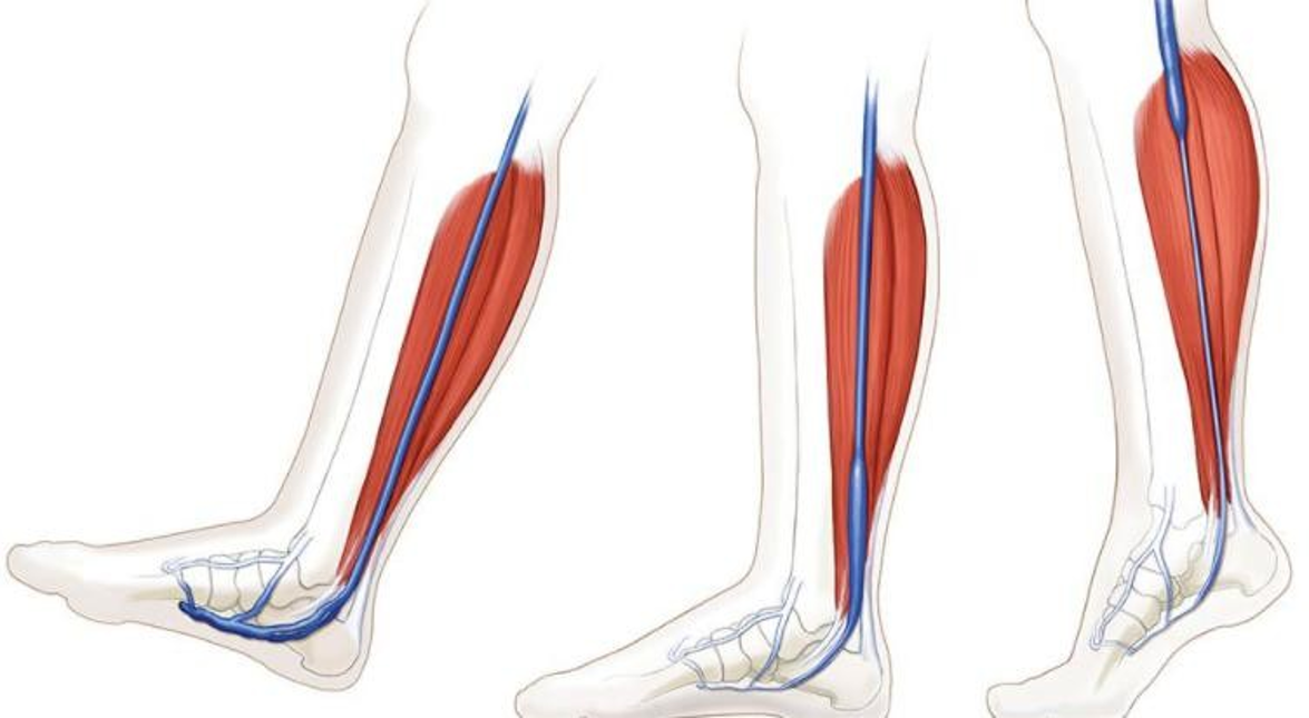 Modern Treatment for Arterial Disease(图1)