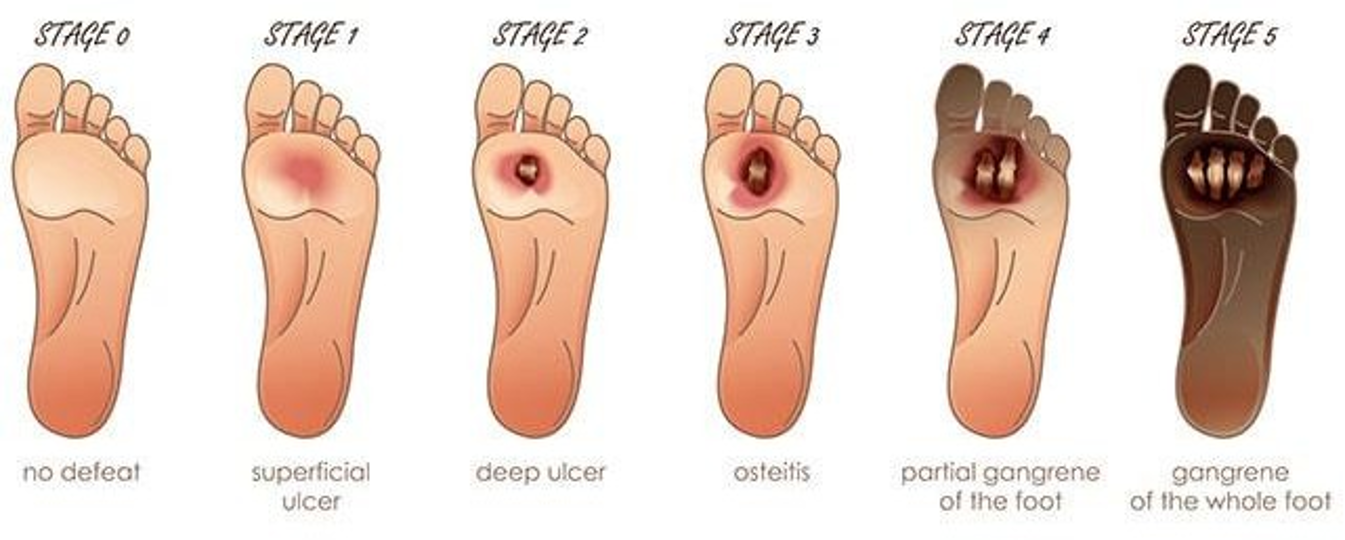 Modern Treatment for Arterial Disease(图10)