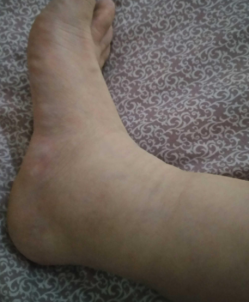 Poor Venous Return(图1)